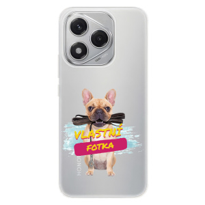 Silikonové pouzdro s vlastní fotkou pro Honor 400 Lite - iSaprio