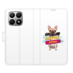 Flip pouzdro iSaprio - Xiaomi 15T s vlastním motivem a kapsičkami na karty