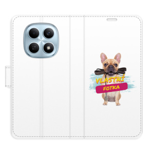 Flip pouzdro iSaprio - Xiaomi Redmi Note 15 4G / 15 5G s vlastním motivem a kapsičkami na karty