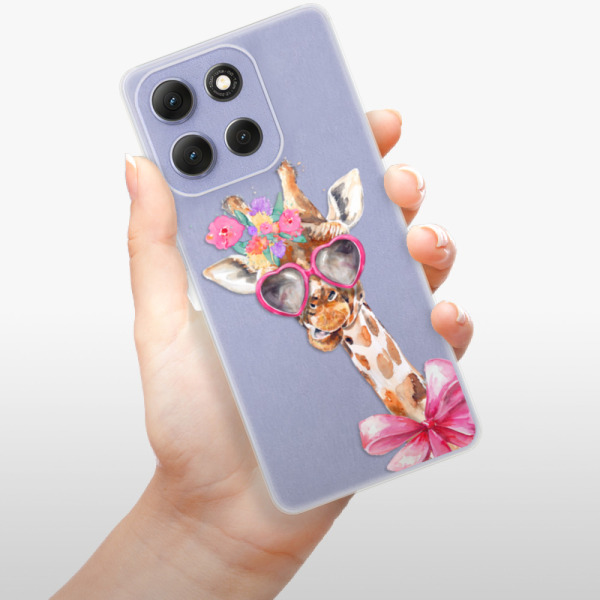 Silikonový kryt iSaprio - Motorola Moto G86 5G - Lady Giraffe