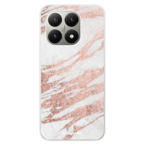 Silikonový kryt iSaprio - Xiaomi 15T - RoseGold 10