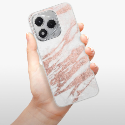 Silikonový obal iSaprio - Honor 400 Lite - RoseGold 10