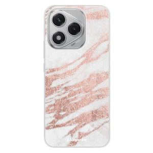 Silikonový obal iSaprio - Honor 400 Lite - RoseGold 10