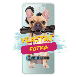 Silikonové pouzdro s vlastní fotkou pro Xiaomi Redmi Note 14 5G - iSaprio