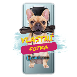 Silikonové pouzdro s vlastní fotkou pro Xiaomi Redmi Note 14 Pro 5G/14 Pro Plus 5G - iSaprio